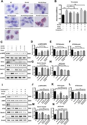 Empagliflozin Alleviates Hepatic Steatosis by Activating the AMPK-TET2-Autophagy Pathway in vivo and in vitro